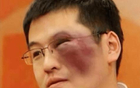 楊毅怒遭打臉，球迷記恨未聘其經(jīng)紀(jì)人！